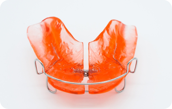 矯正装置の取り外し